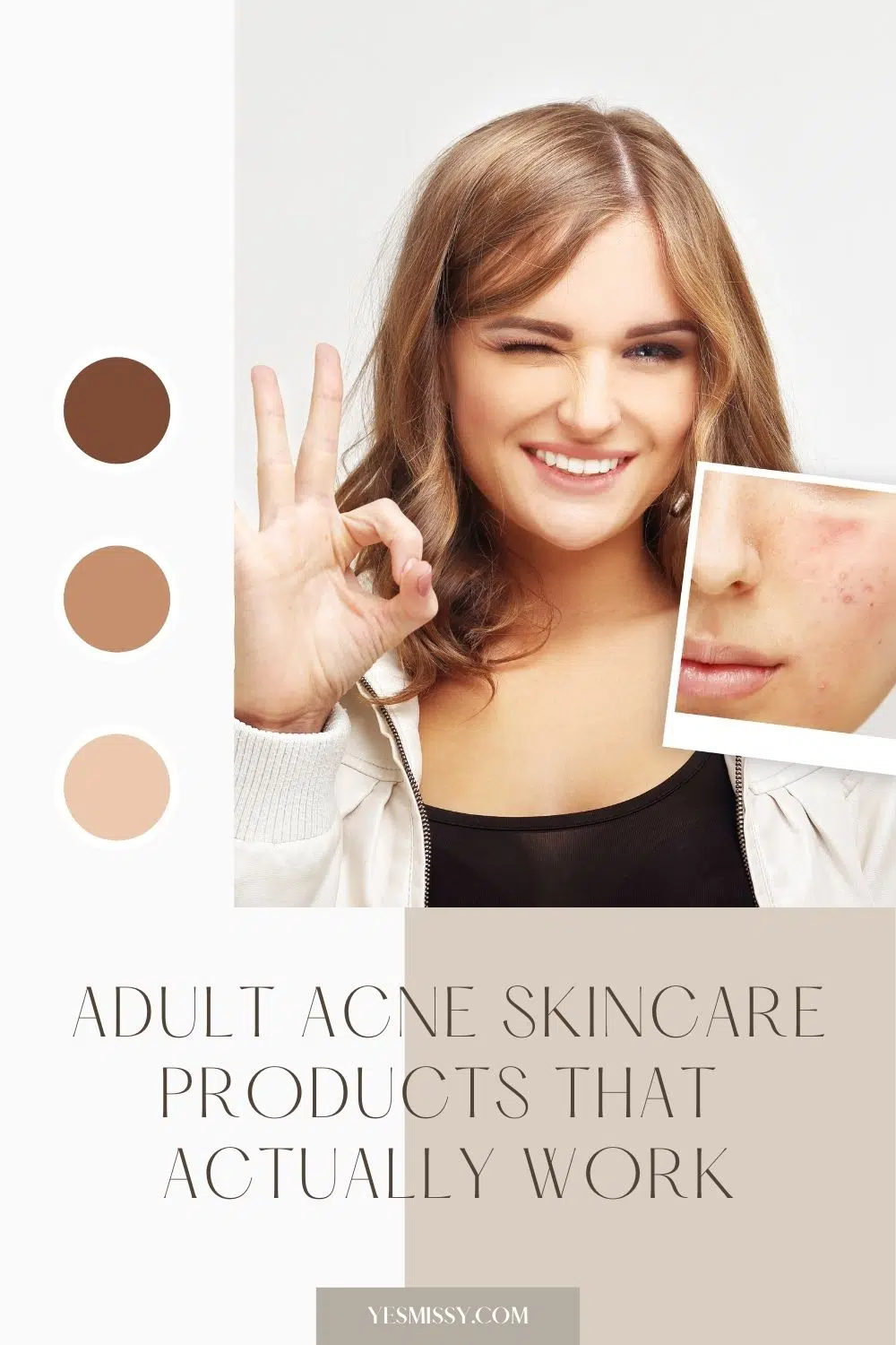 Best over the counter adult acne treatments and skincare products for adults. 